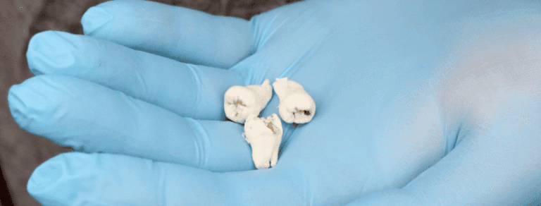Getting-Your-Wisdom-Tooth-Removed-1-845x321 (1)