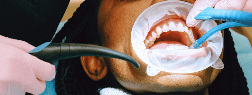 Philadelphia has dental cleanings - Preventive Oral Care Strategies - Root Canal vs. Tooth Extraction