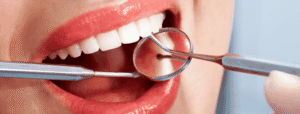 What Happens at Dental Checkups A Comprehensive Guide to Maintain Your Oral Health (2)